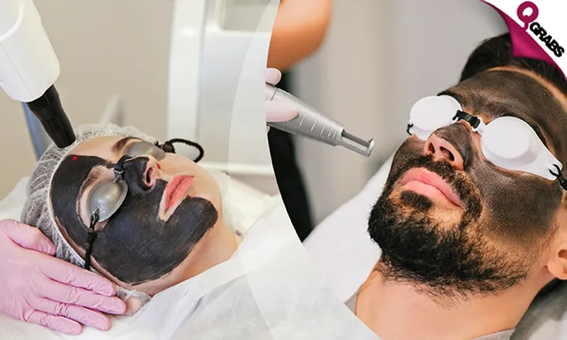 Carbon Laser for Face, Hair & Dark Areas!